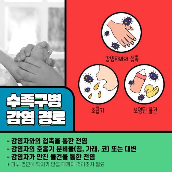 여름철 우리 아이 불청객, 수족구병 관리해요!