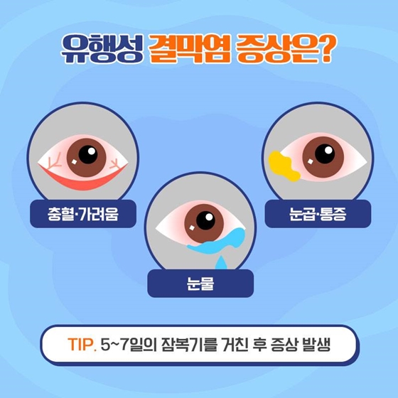 여름철 물놀이 후 골칫거리, 유행성 결막염