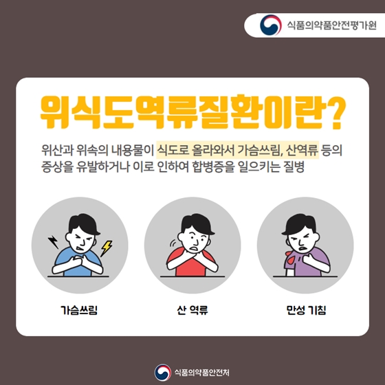 위식도역류질환치료제 알아보기