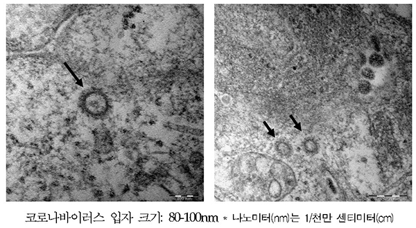 코로나19 바이러스(SARS-CoV-2)의 전자현미경 사진.