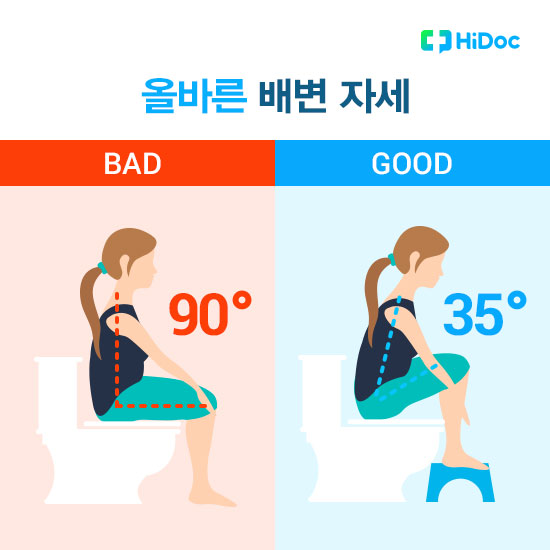 변비와 치질을 예방하는 배변 자세 