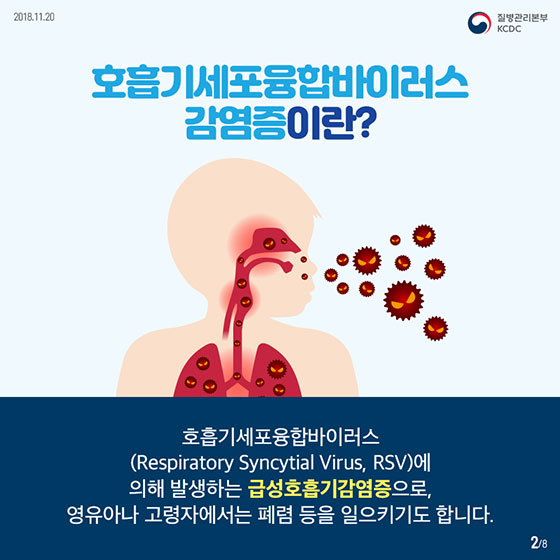 감기처럼 왔다가 폐렴까지?