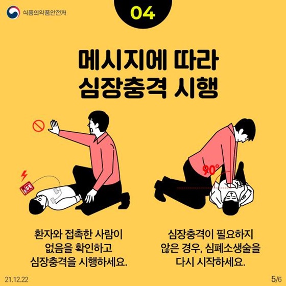 메시지에 따라 심장충격 시행