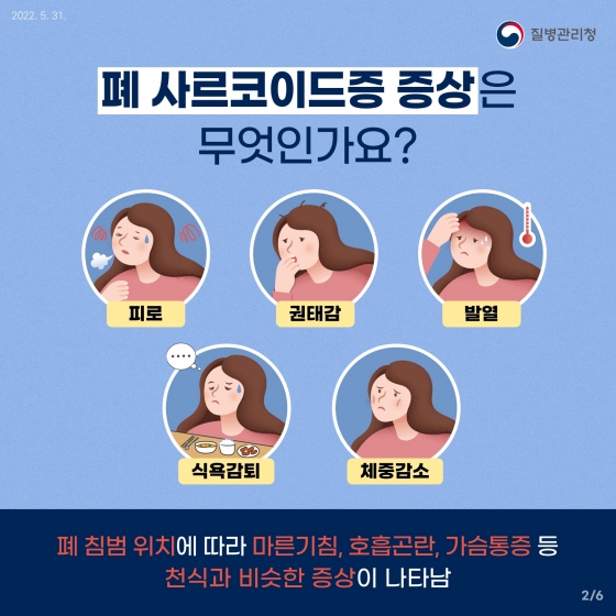 담배도 피우지 않는데 마른 기침이 발생한다면 혹시.. ‘폐 사르코이드증’?