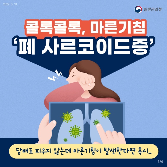 담배도 피우지 않는데 마른 기침이 발생한다면 혹시.. ‘폐 사르코이드증’?