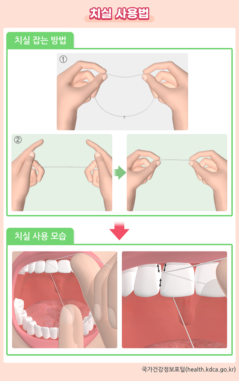 치실 사용법